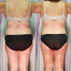 Chiropractic Lutz FL Red Light Therapy Chiropractic Lutz FL Red Light Therapy